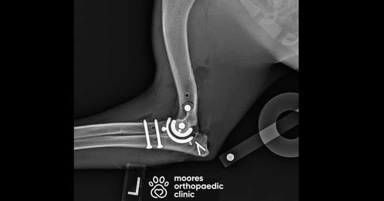 Orthopaedic clinic receives approval for third-generation elbow surgery 